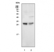 Western blot testing of human 1) HCCT and 2) HCCP cell lysate with Serum Amyloid P antibody at 0.5ug/ml. Predicted molecular weight ~25 kDa.