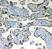 IHC testing of FFPE human placental tissue with BLIMP1 antibody at 1ug/ml. Required HIER: steam section in pH6 citrate buffer for 20 min and allow to cool prior to staining.