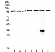 Western blot testing of human 1) HeLa, 2) placenta, 3) COLO320, 4) HepG2, 5) A549, 6) MCF7 and 7) 22RV1 lysate with DGCR8 antibody at 0.5ug/ml. Predicted molecular weight ~86 kDa but can be observed up to ~120 kDa.