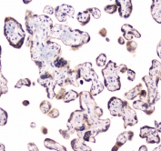 IHC testing of FFPE human placental tissue with CLPX antibody at 1ug/ml. Required HIER: steam section in pH6 citrate buffer for 20 min and allow to cool prior to staining.