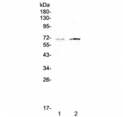Western blot testing of human 1) HeLa and 2) HepG2 cell lysate with CLPX antibody at 0.5ug/ml. Predicted molecular weight ~69 kDa.