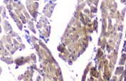 IHC staining of FFPE mouse heart with CLPX antibody at 1ug/ml. HIER: boil tissue sections in pH6, 10mM citrate buffer, for 10-20 min and allow to cool before testing.