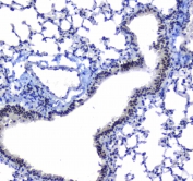 IHC testing of FFPE human placental tissue with SF1 antibody at 1ug/ml. Required HIER: steam section in pH6 citrate buffer for 20 min and allow to cool prior to staining.