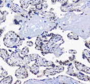 IHC testing of FFPE mouse lung tissue with SF1 antibody at 1ug/ml. Required HIER: steam section in pH6 citrate buffer for 20 min and allow to cool prior to staining.