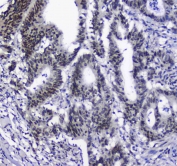 IHC testing of FFPE rat lung tissue with SF1 antibody at 1ug/ml. Required HIER: steam section in pH6 citrate buffer for 20 min and allow to cool prior to staining.