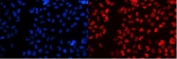 Immunofluorescent staining of FFPE human A431 cells with SF1 antibody (red) at 2ug/ml and DAPI nuclear stain (blue). HIER: steam section in pH6 citrate buffer for 20 min.