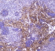 IHC testing of FFPE rat spleen tissue with Vcam-1 antibody at 1ug/ml. Required HIER: steam section in pH6 citrate buffer for 20 min and allow to cool prior to staining.