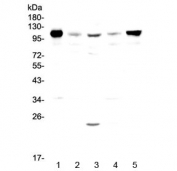 Western blot testing of rat 1) spleen, 2) thymus, 3) testis, 4) kidney and 5) lung lysate with Vcam-1 antibody at 0.5ug/ml. Expected molecular weight: 74-110 kDa depending on glycosylation level.