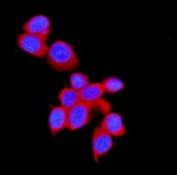 Immunofluorescent staining of FFPE human MCF7 cells with STUB1 antibody (red) and DAPI nuclear stain (blue). HIER: steam section in pH6 citrate buffer for 20 min.