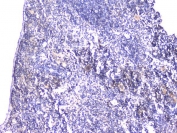 IHC testing of FFPE mouse spleen tissue with STUB1 antibody at 1ug/ml. Required HIER: steam section in pH6 citrate buffer for 20 min and allow to cool prior to staining.