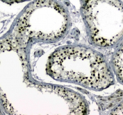 IHC testing of FFPE human testis tissue with MDC1 antibody at 1ug/ml. Required HIER: steam section in pH6 citrate buffer for 20 min and allow to cool prior to staining.