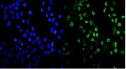 Immunofluorescent staining of FFPE human A431 cells with MDC1 antibody (green) and DAPI nuclear stain (blue). HIER: steam section in pH6 citrate buffer for 20 min.