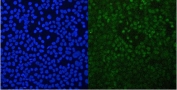 Immunofluorescent staining of FFPE human A431 cells with GNB1 antibody (green) at 2ug/ml and DAPI nuclear stain (blue). HIER: steam section in pH6 citrate buffer for 20 min.