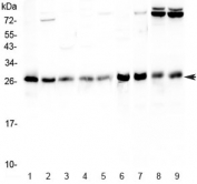 Western blot testing of human 1) HeLa, 2) Jurkat, 3) MCF7, 4) HepG2, 5) A549, 6) rat stomach, 7) rat thymus, 8) mouse thymus and 9) mouse NIH3T3 lysate with RAB27A antibody at 0.5ug/ml. Predicted molecular weight: 25-27 kDa.
