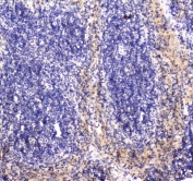 IHC testing of FFPE mouse spleen tissue with RAB27A antibody at 1ug/ml. Required HIER: steam section in pH6 citrate buffer for 20 min and allow to cool prior to staining.