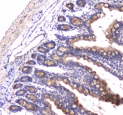 IHC testing of FFPE rat small intestine tissue with RAB27A antibody at 1ug/ml. Required HIER: steam section in pH6 citrate buffer for 20 min and allow to cool prior to staining.