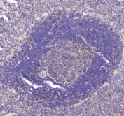 IHC testing of FFPE rat spleen tissue with RAB27A antibody at 1ug/ml. Required HIER: steam section in pH6 citrate buffer for 20 min and allow to cool prior to staining.