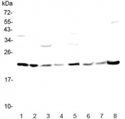 Western blot testing of rat 1) brain, 2) testis, 3) spleen, 4) thymus and mouse 5) brain, 6) testis, 7) thymus and 8) liver lysate with GLO1 antibody at 0.5ug/ml. Predicted molecular weight ~21 kDa.