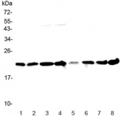 Western blot testing of human 1) HeLa, 2) placenta, 3) MCF7, 4) COLO320, 5) 22RV1, 6) HepG2, 7) A431 and 8) U937 lysate with GLO1 antibody at 0.5ug/ml. Predicted molecular weight ~21 kDa.