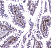 IHC testing of FFPE rat small intestine tissue with GLO1 antibody at 1ug/ml. Required HIER: steam section in pH6 citrate buffer for 20 min and allow to cool prior to staining.