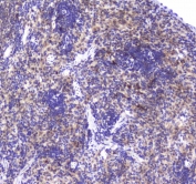 IHC testing of FFPE rat spleen tissue with GLO1 antibody at 1ug/ml. Required HIER: steam section in pH6 citrate buffer for 20 min and allow to cool prior to staining.