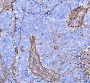 Flow cytometry testing of human A549 cells with S100A10 antibody at 1ug/10^6 cells (blocked with goat sera); Red=cells alone, Green=isotype control, Blue= S100A10 antibody.