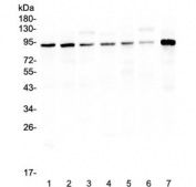 Western blot testing of rat 1) brain 2) lung, 3) liver and mouse 4) brain, 5) lung, 6) liver, 7) testis lysate with UBA2 antibody at 0.5ug/ml. Predicted molecular weight: ~72 kDa but routinely observed at ~90 kDa.
