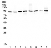 Western blot testing of human 1) HeLa 2) placenta, 3) MCF7, 4) A549, 5) SK-OV-3, 6) 22RV1, 7) A431 and 8) COLO320 lysate with UBA2 antibody at 0.5ug/ml. Predicted molecular weight: ~72 kDa but routinely observed at ~90 kDa.