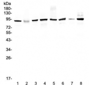 Western blot testing of human 1) HeLa 2) placenta, 3) MCF7, 4) A549, 5) SK-OV-3, 6) 22RV1, 7) A431 and 8) COLO320 lysate with UBA2 antibody at 0.5ug/ml. Predicted molecular weight: ~72 kDa but routinely observed at ~90 kDa.