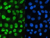IF/ICC staining of FFPE human A431 cells with UBA2 antibody (green) at 2ug/ml and DAPI nuclear stain (blue). Required HIER: steam section in pH6 citrate buffer for 20 min and allow to cool prior to staining.
