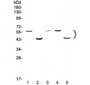 Western blot testing of rat 1) thymus, 2) liver and mouse 3) spleen, 4) thymus and 5) liver lysate with Caspase 8 antibody at 0.5ug/ml. Predicted molecular weight: ~55 kDa (pro), ~40 kDa (large + small subunit), ~11 kDa (small subunit).