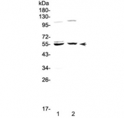 Western blot testing of human 1) HeLa and 2) SGC-7901 cell lysate with Caspase 8 antibody at 0.5ug/ml. Predicted molecular weight: ~55 kDa (pro), ~40 kDa (large + small subunit), ~11 kDa (small subunit).