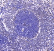 IHC testing of FFPE rat spleen tissue with CD80 antibody at 1ug/ml. Required HIER: steam section in pH6 citrate buffer for 20 min and allow to cool prior to staining.