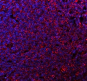 IHC testing of FFPE rat spleen tissue with CD80 antibody at 1ug/ml. Required HIER: steam section in pH6 citrate buffer for 20 min and allow to cool prior to staining.