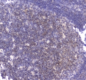 IHC testing of FFPE human tonsil tissue with CD80 antibody at 1ug/ml. Required HIER: steam section in pH6 citrate buffer for 20 min and allow to cool prior to staining.