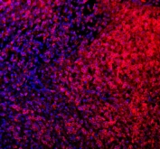 Immunofluorescent staining of FFPE human spleen tissue with CD80 antibody (red) and DAPI nuclear stain (blue). HIER: steam section in pH8 EDTA buffer for 20 min.