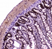 IHC testing of FFPE rat small intestine tissue with BRG1 antibody at 1ug/ml. Required HIER: steam section in pH6 citrate buffer for 20 min and allow to cool prior to staining.