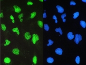 IF/ICC staining of FFPE human U-2 OS cells with BRG1 antibody (green) at 2ug/ml and DAPI nuclear stain (blue). HIER: steam section in pH6 citrate buffer for 20 min.