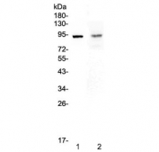 Western blot testing of 1) rat spleen and 2) mouse intestine lysate with TLR1 antibody at 0.5ug/ml. Predicted molecular weight ~90 kDa.