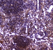IHC testing of FFPE mouse spleen tissue with TLR1 antibody at 1ug/ml. Required HIER: steam section in pH6 citrate buffer for 20 min and allow to cool prior to staining.