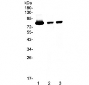Western blot testing of 1) human placenta, 2) rat spleen and 3) mouse spleen tissue lysate with Lactoferrin antibody at 0.5ug/ml. Predicted molecular weight: ~78 kDa (isoform 1) and ~73 kDa (isoforms 2).