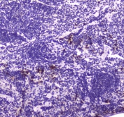 IHC testing of FFPE mouse spleen tissue with Lactoferrin antibody at 1ug/ml. Required HIER: steam section in pH6 citrate buffer for 20 min and allow to cool prior to staining.