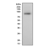 Western blot testing of human HCCP cell lysate with Lactoferrin antibody at 0.5ug/ml. Predicted molecular weight: ~78 kDa (isoform 1) and ~73 kDa (isoforms 2).