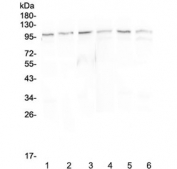 Western blot testing of 1) rat spleen, 2) rat lung, 2) rat kidney, 4) mouse spleen, 5) mouse lung and 6) mouse kidney lysate with MVP antibody at 0.5ug/ml. Observed molecular weight: 104~110 kDa.