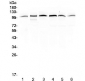 Western blot testing of human 1) placenta, 2) HepG2, 3) A549, 4) PANC-1, 5) SGC-7901 and 6) MDA-MB-231 lysate with MVP antibody at 0.5ug/ml. Observed molecular weight: 104~110 kDa.
