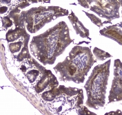 IHC testing of FFPE mouse small intestine tissue with MVP antibody at 1ug/ml. Required HIER: steam section in pH6 citrate buffer for 20 min and allow to cool prior to staining.