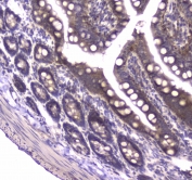 IHC testing of FFPE rat small intestine tissue with MVP antibody at 1ug/ml. Required HIER: steam section in pH6 citrate buffer for 20 min and allow to cool prior to staining.