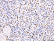 IHC staining of FFPE human spleen tissue with CD163 antibody at 1ug/ml. Required HIER: steam section in pH8 EDTA for 20 min and allow to cool prior to staining.