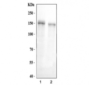 Western blot testing of human 1) HCCT and 2) HCCP cell lysate with CD163 antibody. Expected molecular weight: 125-175 kDa depending on glycosylation level.