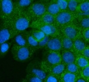 Immunofluorescent staining of FFPE human A431 cells with M6PR antibody (green) and DAPI nuclear stain (blue). HIER: steam section in pH6 citrate buffer for 20 min.